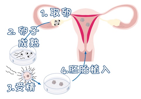 冷冻设备